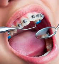 Orthodontics